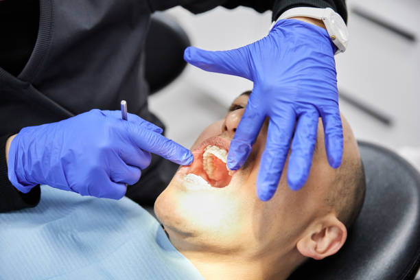 Best Cracked Tooth Emergency Dentist  in Mcdonough, GA